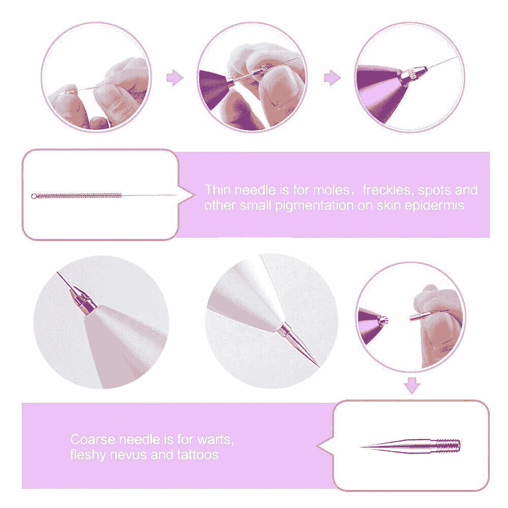 Electric laser plasma pen for mole removal and dark spot removal,