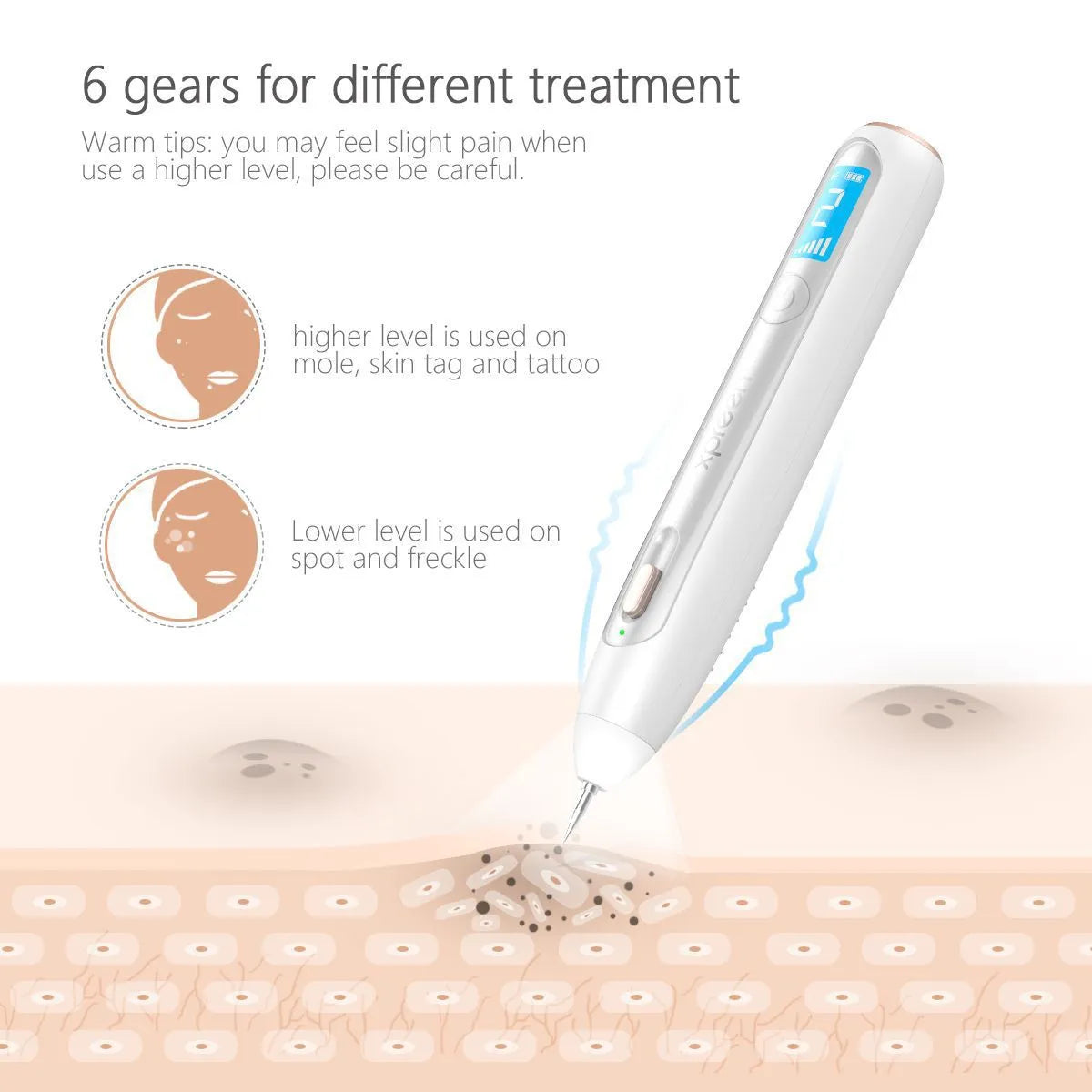 LCD Laser Pen Wart Remover